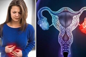 Những dấu hiệu dễ nhận biết của ung thư buồng trứng giai đoạn đầu