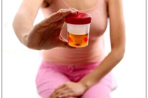 Cẩn trọng với bệnh ung thư bàng quang ở phụ nữ