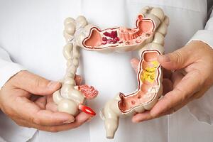 Tại sao nên tầm soát ung thư đường tiêu hóa từ sớm?