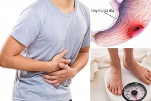 Bạn đã biết: 7 triệu chứng và 5 yêu cầu cần thiết giúp phát hiện sớm bệnh ung thư?