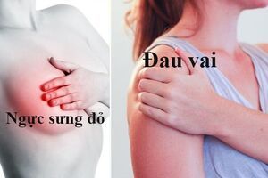Đi khám ngay nếu xuất hiện những dấu hiệu ung thư vú này