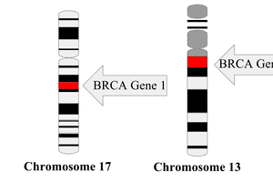 Đột biến gen BRCA1 và BRCA2 - nguyên nhân hàng đầu gây ung thư vú