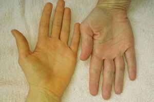 Những câu hỏi thường gặp về ung thư gan