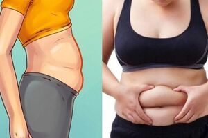 Vòng eo lớn hơn có thể làm tăng nguy cơ ung thư gan?