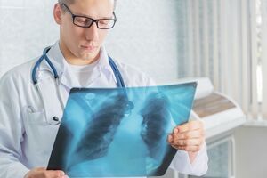 23 sự thật về ung thư phổi, bạn đã biết?